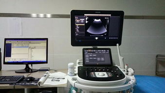 旬陽(yáng)縣醫(yī)院成功引進(jìn)先進(jìn)超聲設(shè)備，正式開通新生兒顱腦超聲檢查服務(wù)